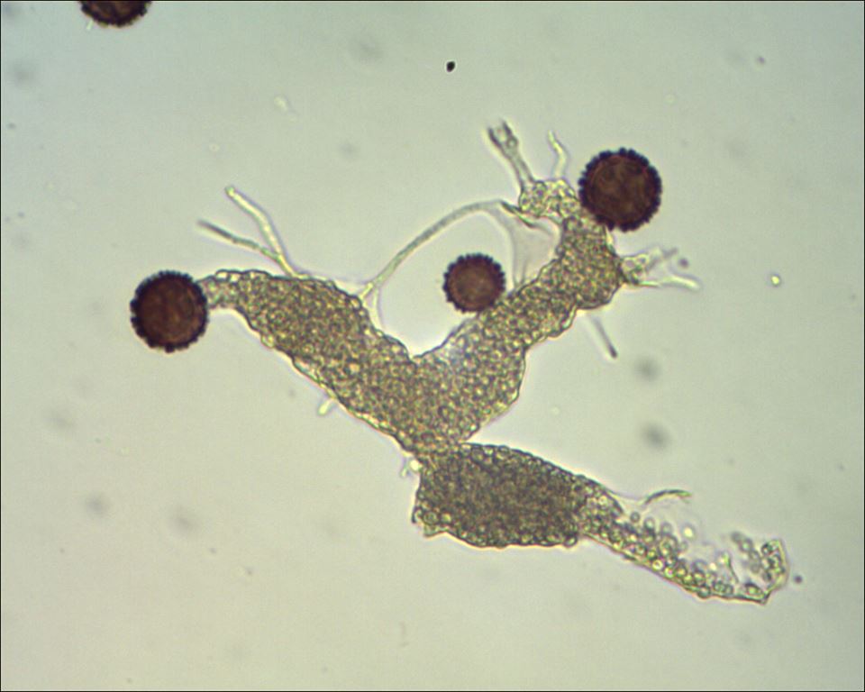 unkown myxomycete